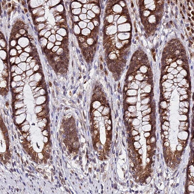 RNF121 Antibody - BSA Free Immunohistochemistry: RNF121 Antibody - BSA Free [NBP1-92339]