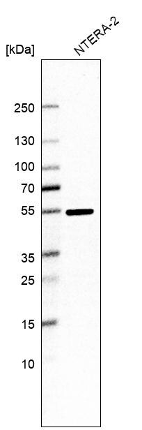 RNPS1 Antibody - BSA Free Western Blot: RNPS1 Antibody - BSA Free [NBP1-92343]