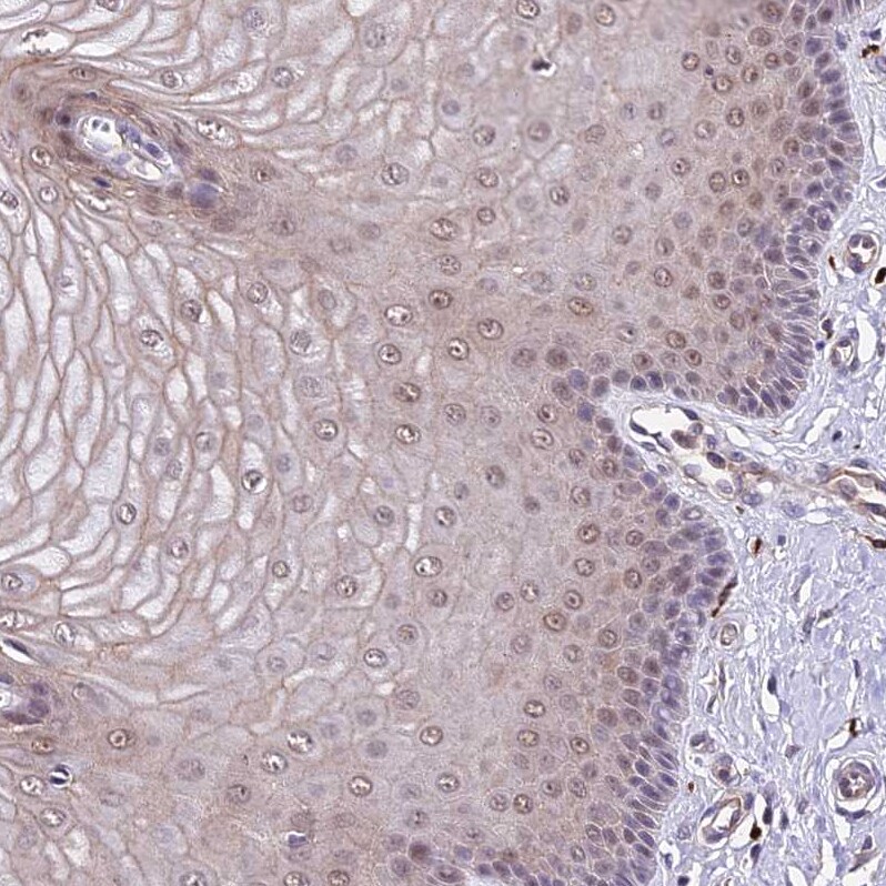 RPB9 Antibody - BSA Free Immunohistochemistry: RPB9 Antibody - BSA Free [NBP1-92344]