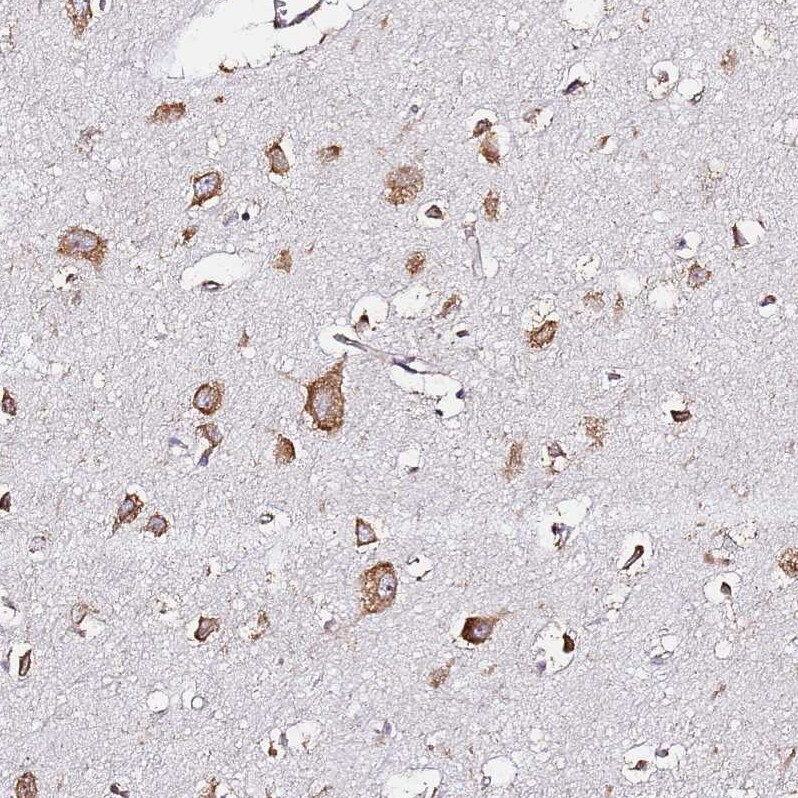 RPL13A Antibody - BSA Free Immunohistochemistry: RPL13A Antibody - BSA Free [NBP1-92345]