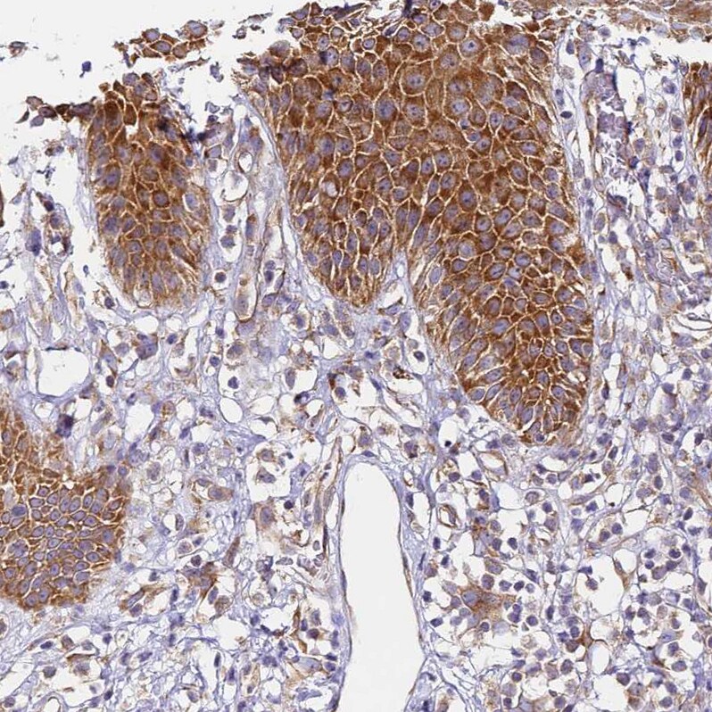 RPL13A Antibody - BSA Free Immunohistochemistry: RPL13A Antibody - BSA Free [NBP1-92345]
