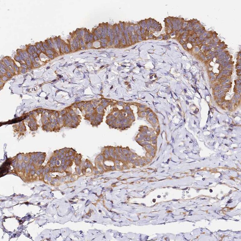 RPL13A Antibody - BSA Free Immunohistochemistry: RPL13A Antibody - BSA Free [NBP1-92345]