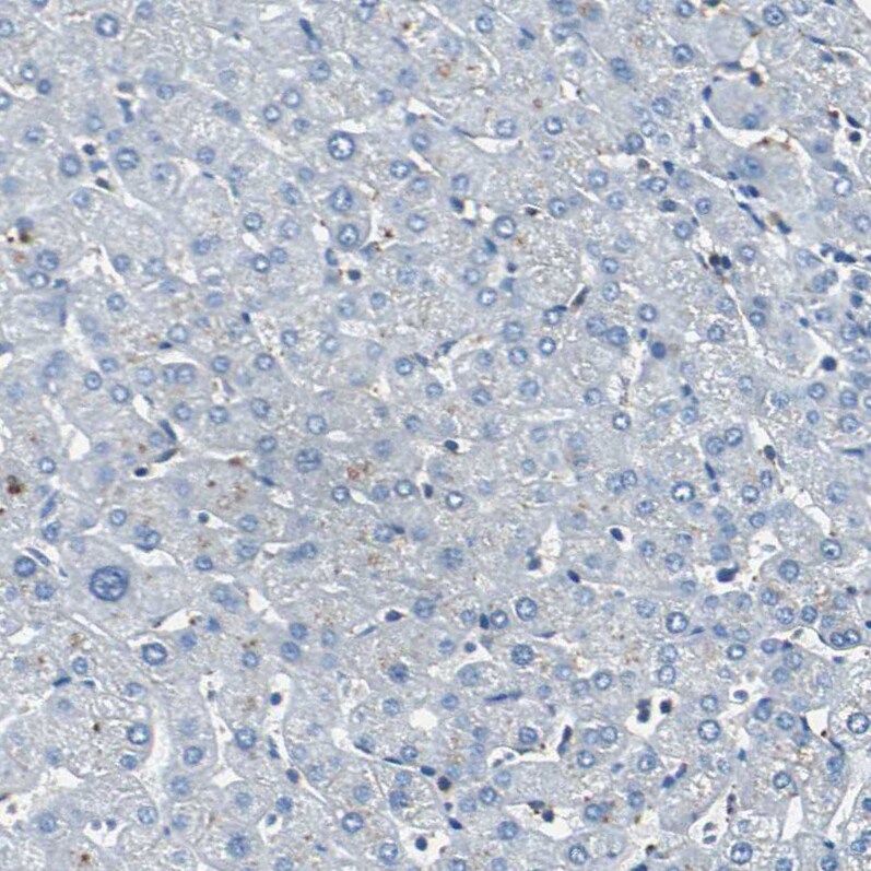 RPS13 Antibody - BSA Free Immunohistochemistry: RPS13 Antibody - BSA Free [NBP1-92350]