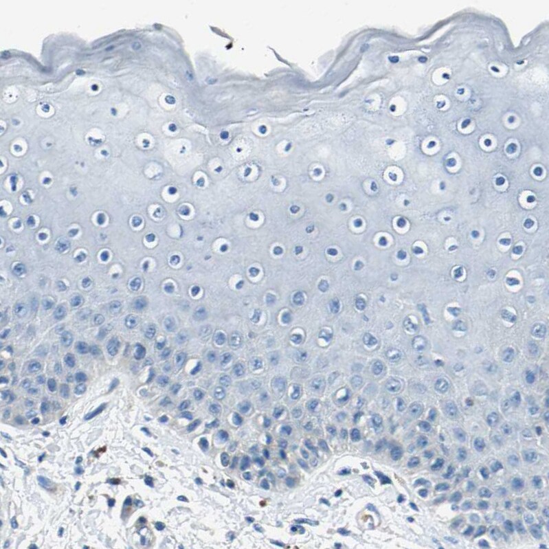 RPS13 Antibody - BSA Free Immunohistochemistry: RPS13 Antibody - BSA Free [NBP1-92350]