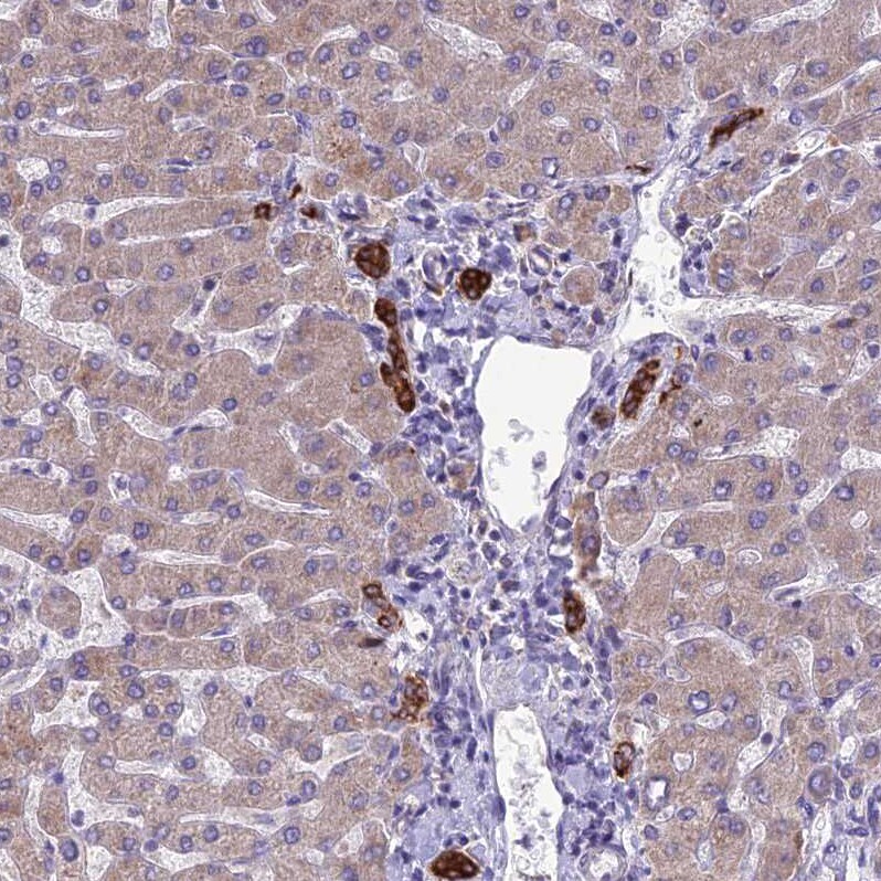 RPS26 Antibody - BSA Free Immunohistochemistry: RPS26 Antibody - BSA Free [NBP1-92352]