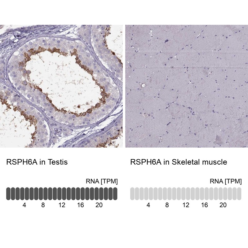 RSHL1 Antibody - BSA Free Immunohistochemistry: RSHL1 Antibody - BSA Free [NBP1-92356]