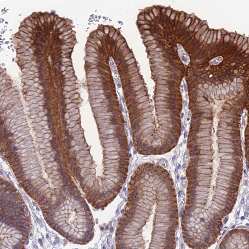NgR3/NgRH2/RTN4RL1 Antibody - BSA Free Immunohistochemistry: NgR3/NgRH2/RTN4RL1 Antibody - BSA Free [NBP1-92359]