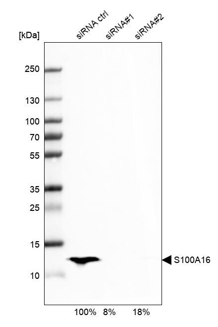 S100A16 Antibody - BSA Free Western Blot: S100A16 Antibody - BSA Free [NBP1-92361]