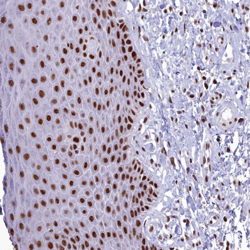SAP130 Antibody - BSA Free Immunohistochemistry: SAP130 Antibody - BSA Free [NBP1-92362]