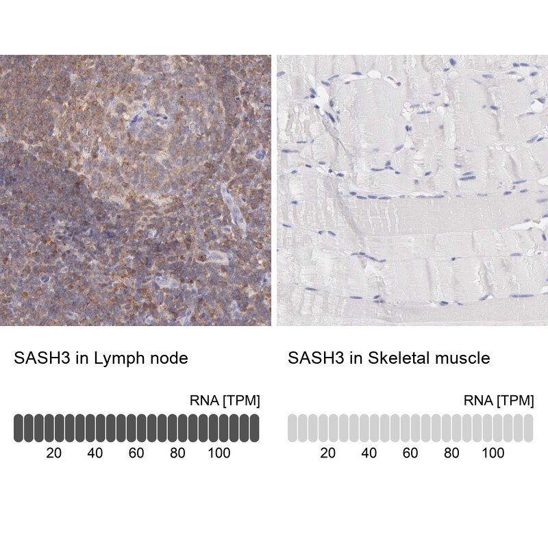 SASH3 Antibody - BSA Free Immunohistochemistry: SASH3 Antibody - BSA Free [NBP1-92364]
