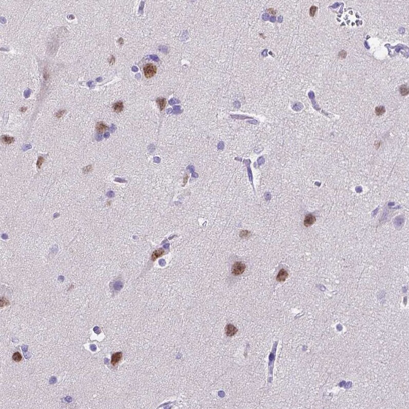 SATB2 Antibody - BSA Free Immunohistochemistry: SATB2 Antibody - BSA Free [NBP1-92365]