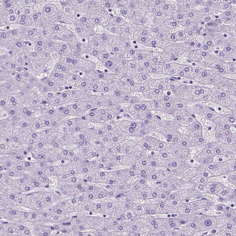 SATB2 Antibody - BSA Free Immunohistochemistry: SATB2 Antibody - BSA Free [NBP1-92365]