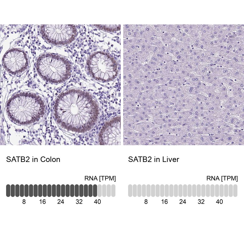 SATB2 Antibody - BSA Free Immunohistochemistry: SATB2 Antibody - BSA Free [NBP1-92365]