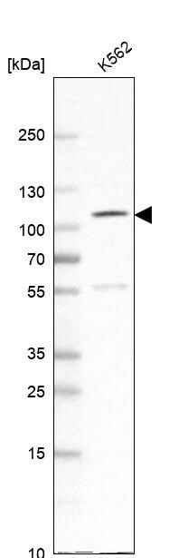 SATB2 Antibody - BSA Free Western Blot: SATB2 Antibody - BSA Free [NBP1-92365]