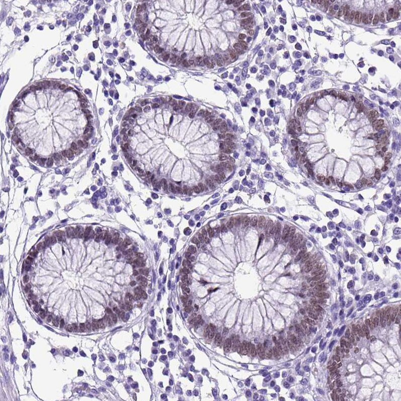 SATB2 Antibody - BSA Free Immunohistochemistry: SATB2 Antibody - BSA Free [NBP1-92365]