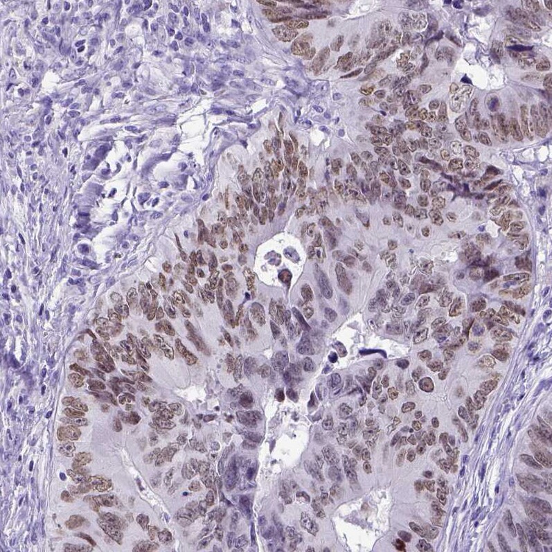 SATB2 Antibody - BSA Free Immunohistochemistry: SATB2 Antibody - BSA Free [NBP1-92365]
