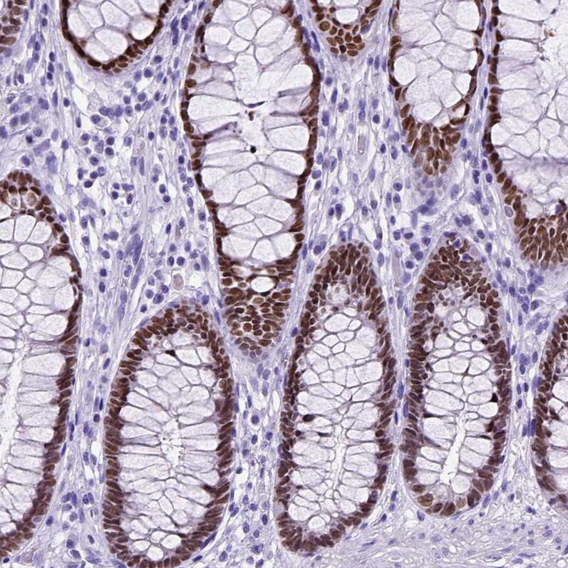 SATB2 Antibody - BSA Free Immunohistochemistry: SATB2 Antibody - BSA Free [NBP1-92365]