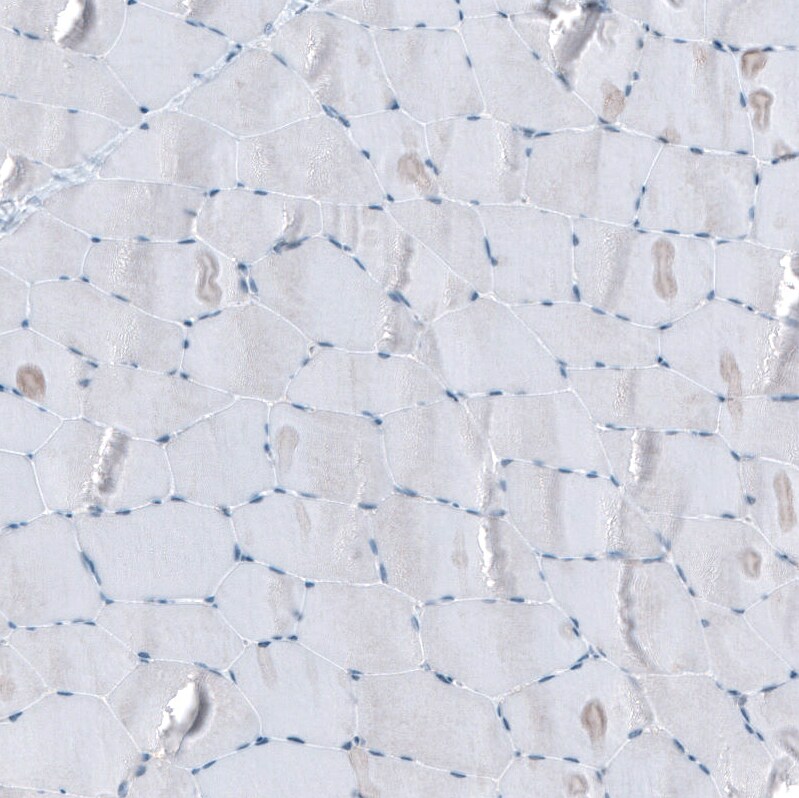 SCRT1 Antibody - BSA Free Immunohistochemistry: SCRT1 Antibody - BSA Free [NBP1-92369]