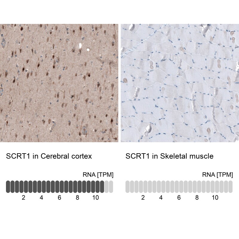SCRT1 Antibody - BSA Free Immunohistochemistry: SCRT1 Antibody - BSA Free [NBP1-92369]