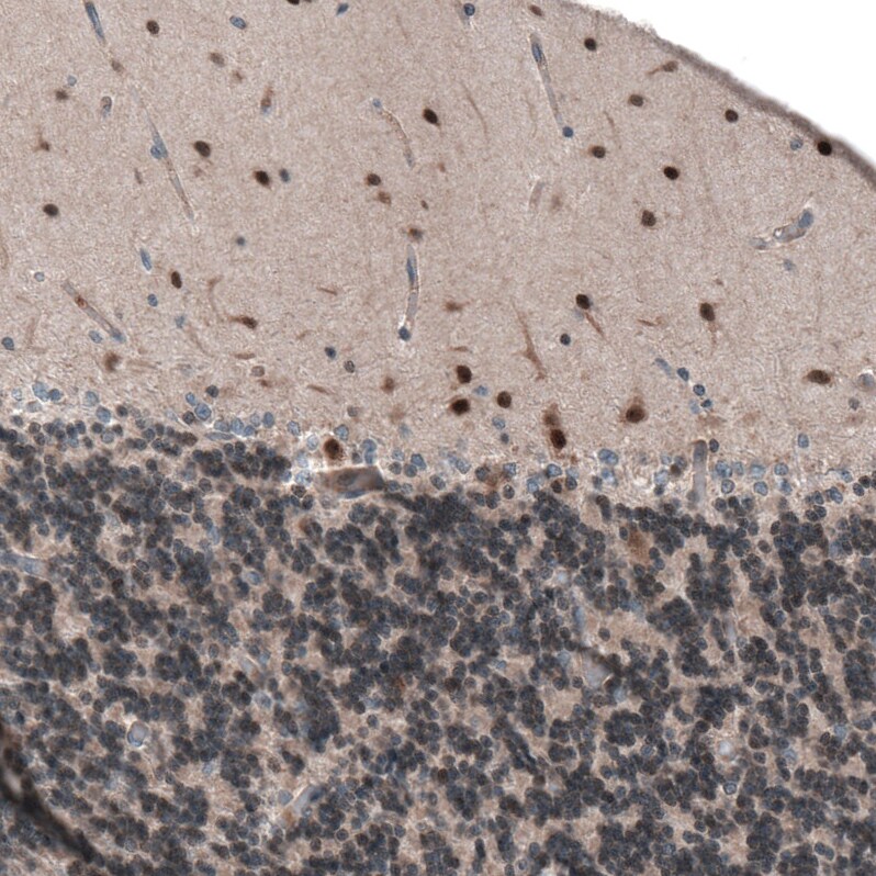 SCRT1 Antibody - BSA Free Immunohistochemistry: SCRT1 Antibody - BSA Free [NBP1-92369]