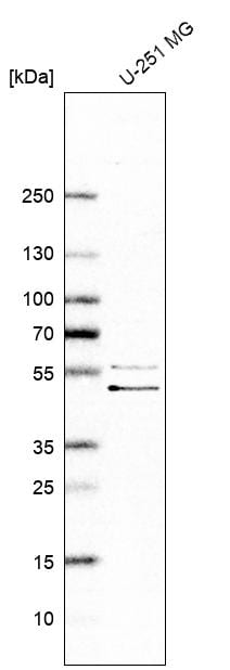 SCYL1BP1 Antibody - BSA Free Western Blot: SCYL1BP1 Antibody - BSA Free [NBP1-92370]