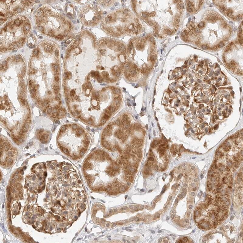 SCYL1BP1 Antibody - BSA Free Immunohistochemistry: SCYL1BP1 Antibody - BSA Free [NBP1-92370]