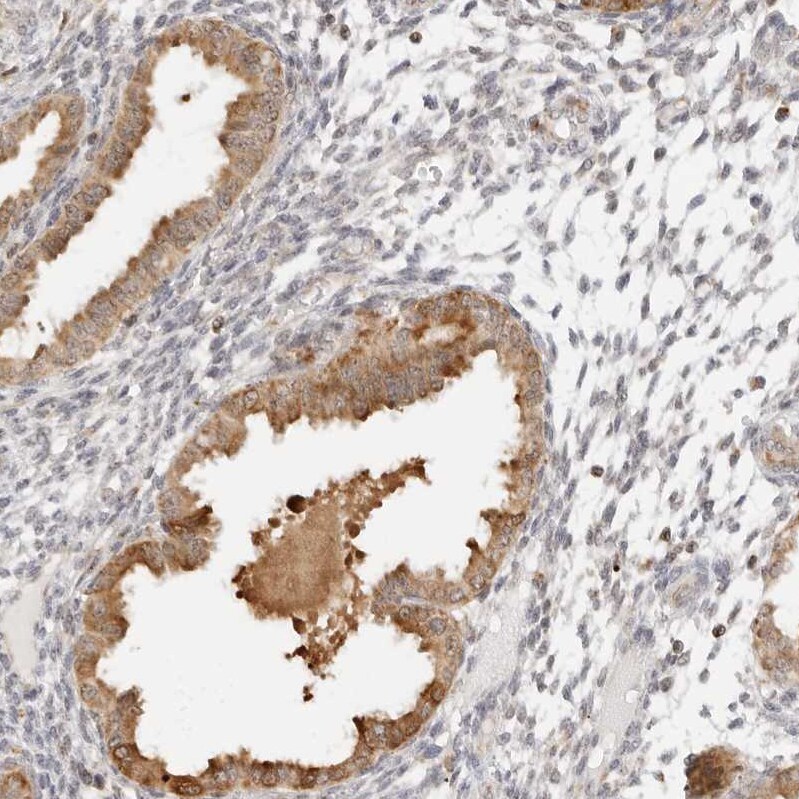 SCYL1BP1 Antibody - BSA Free Immunohistochemistry: SCYL1BP1 Antibody - BSA Free [NBP1-92371]