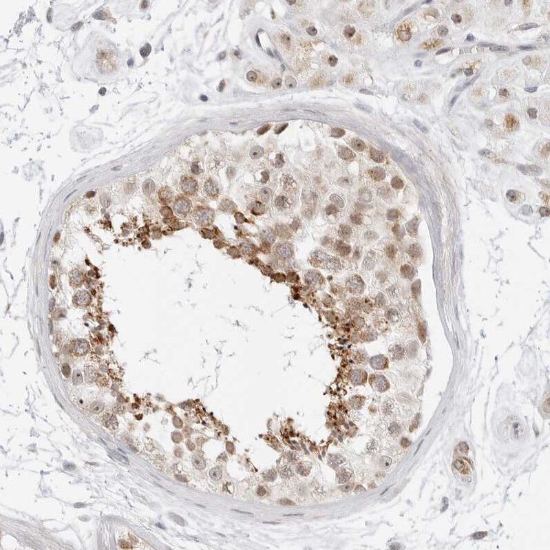 SCYL1BP1 Antibody - BSA Free Immunohistochemistry: SCYL1BP1 Antibody - BSA Free [NBP1-92371]