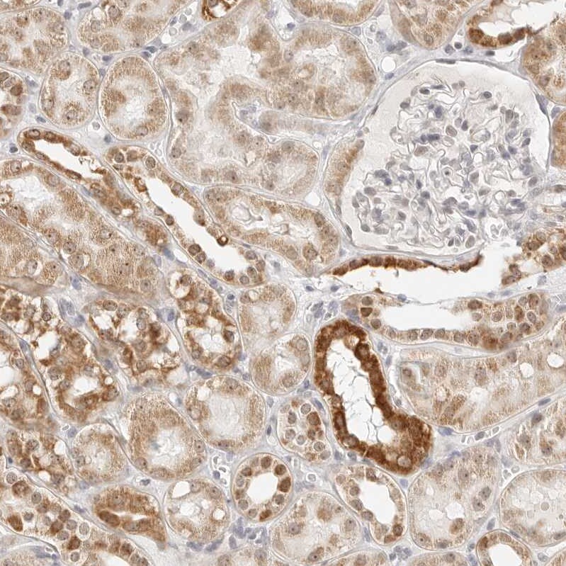 SCYL1BP1 Antibody - BSA Free Immunohistochemistry: SCYL1BP1 Antibody - BSA Free [NBP1-92371]