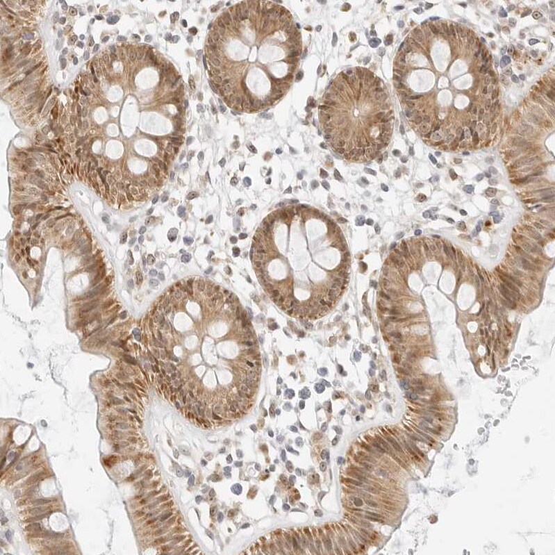 SCYL1BP1 Antibody - BSA Free Immunohistochemistry: SCYL1BP1 Antibody - BSA Free [NBP1-92371]
