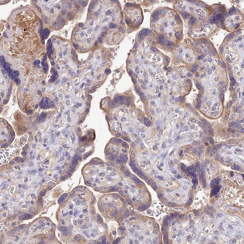 SDHD Antibody - BSA Free Immunohistochemistry: SDHD Antibody - BSA Free [NBP1-92372]