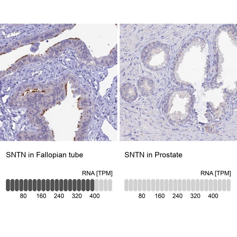 Sentan Antibody - BSA Free Immunohistochemistry: Sentan Antibody - BSA Free [NBP1-92378]