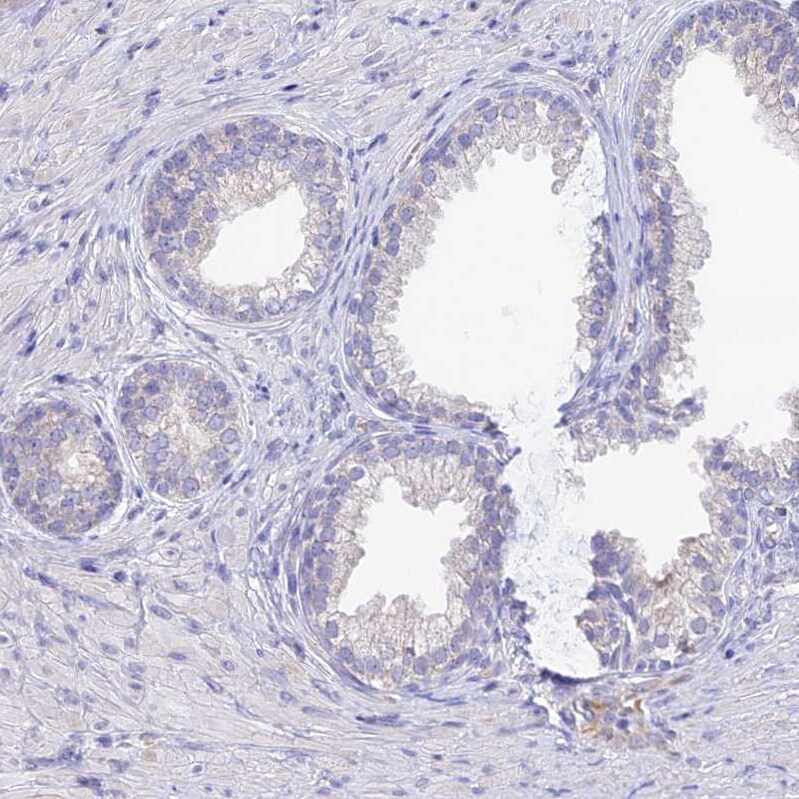 Sentan Antibody - BSA Free Immunohistochemistry: Sentan Antibody - BSA Free [NBP1-92378]