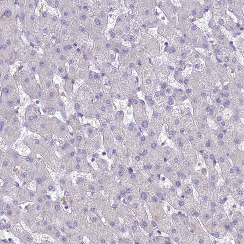 Sentan Antibody - BSA Free Immunohistochemistry: Sentan Antibody - BSA Free [NBP1-92378]