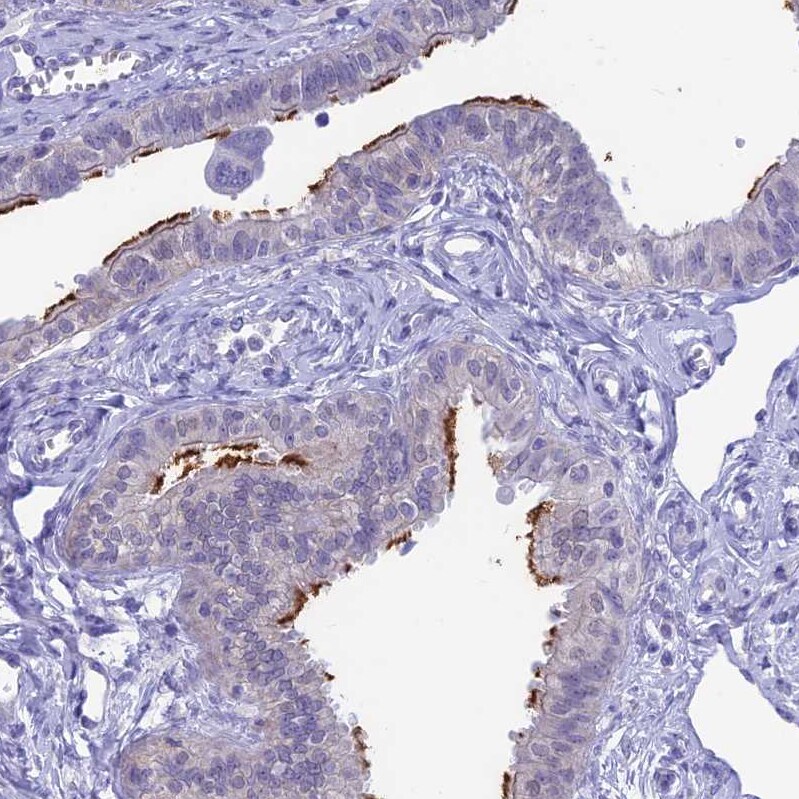 Sentan Antibody - BSA Free Immunohistochemistry: Sentan Antibody - BSA Free [NBP1-92378]
