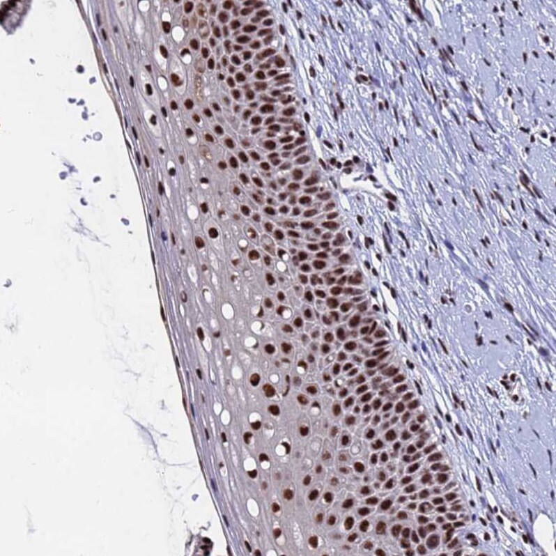 SF3B2 Antibody - BSA Free Immunohistochemistry: SF3B2 Antibody - BSA Free [NBP1-92380]