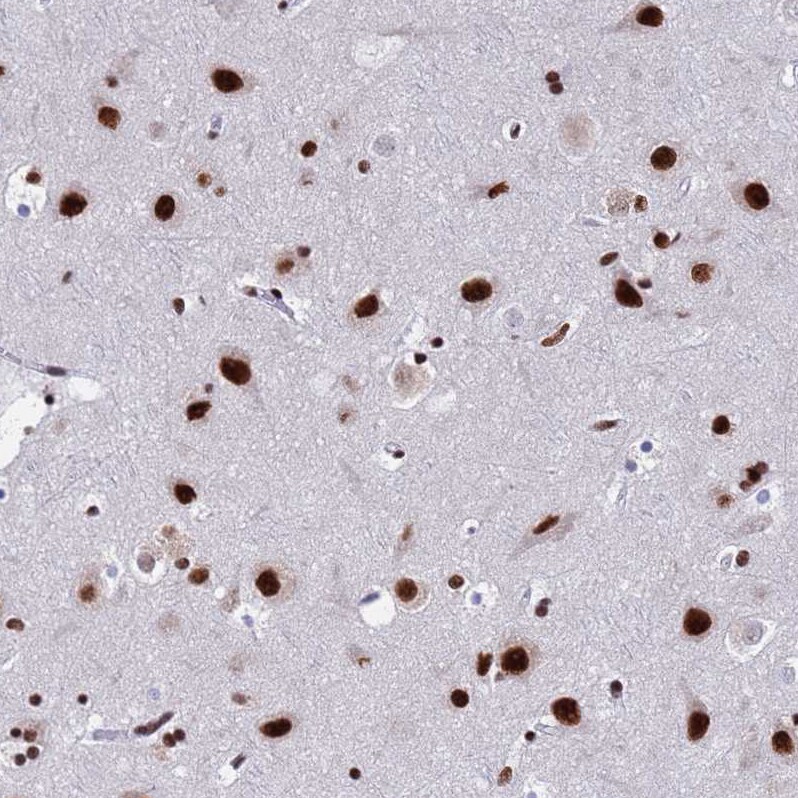 SF3B2 Antibody - BSA Free Immunohistochemistry: SF3B2 Antibody - BSA Free [NBP1-92380]