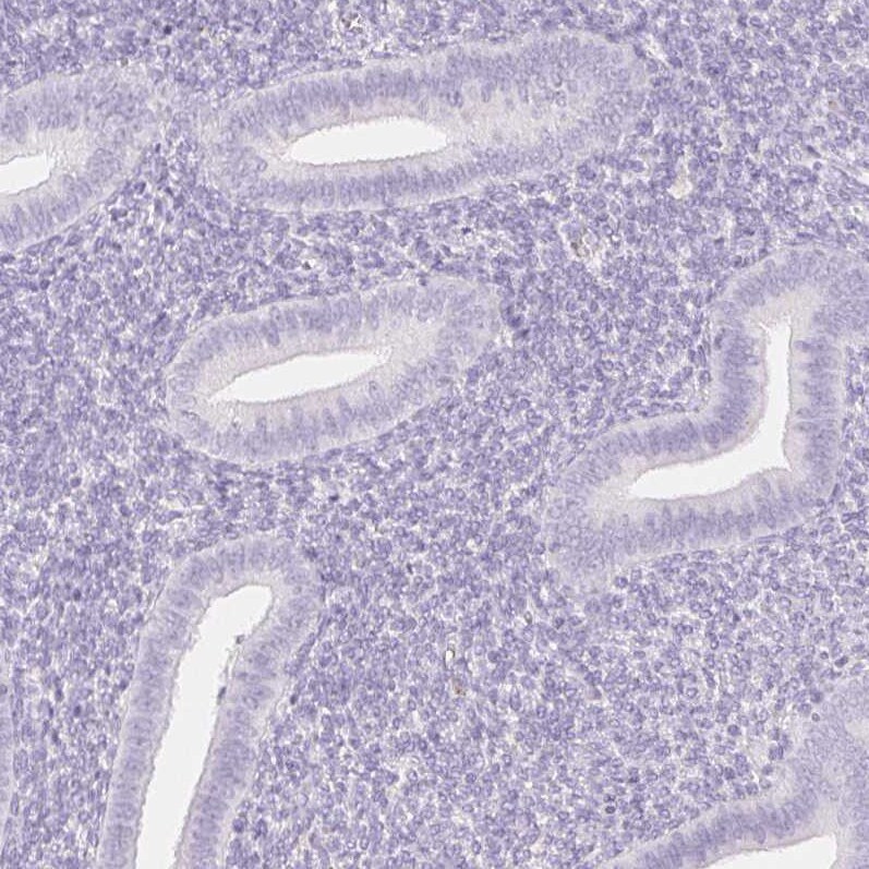 SGLT2/SLC5A2 Antibody - BSA Free Immunohistochemistry: SGLT2/SLC5A2 Antibody - BSA Free [NBP1-92384]