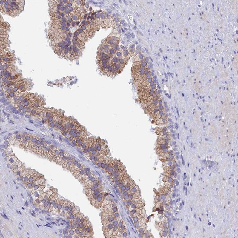 Signal Peptide Peptidase Antibody - BSA Free Immunohistochemistry: Signal Peptide Peptidase Antibody - BSA Free [NBP1-92389]