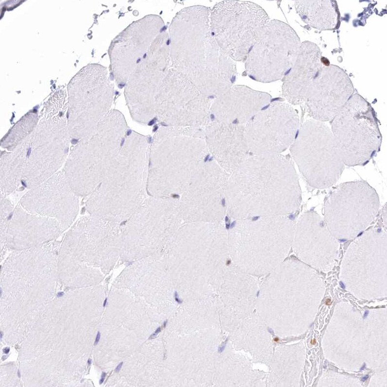 Signal Peptide Peptidase Antibody - BSA Free Immunohistochemistry: Signal Peptide Peptidase Antibody - BSA Free [NBP1-92389]