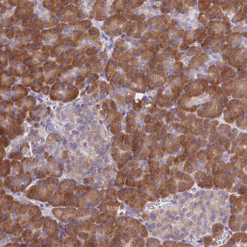 Signal Peptide Peptidase Antibody - BSA Free Immunohistochemistry: Signal Peptide Peptidase Antibody - BSA Free [NBP1-92389]