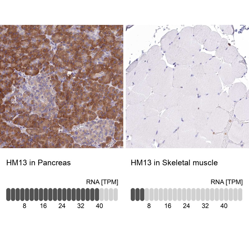 Signal Peptide Peptidase Antibody - BSA Free Immunohistochemistry: Signal Peptide Peptidase Antibody - BSA Free [NBP1-92389]