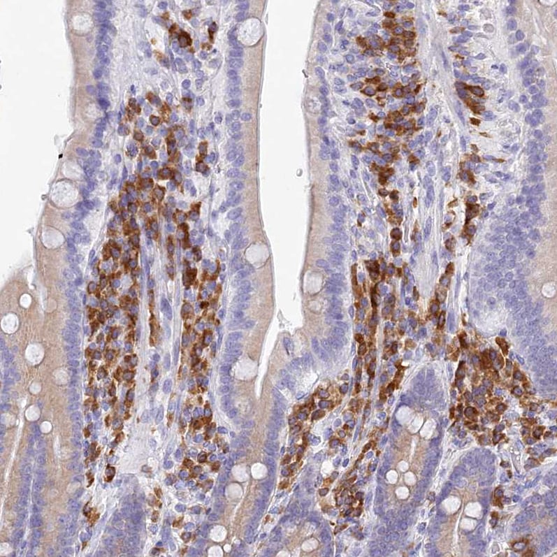 Signal Peptide Peptidase Antibody - BSA Free Immunohistochemistry: Signal Peptide Peptidase Antibody - BSA Free [NBP1-92389]