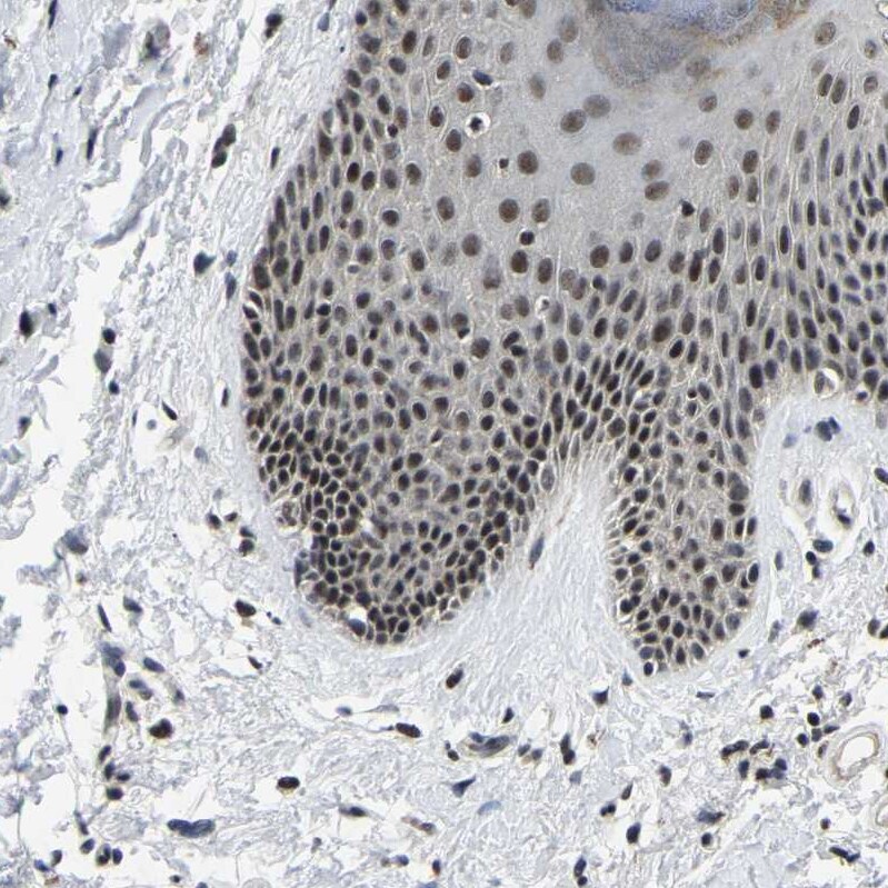 SKAR Antibody - BSA Free Immunohistochemistry: SKAR Antibody - BSA Free [NBP1-92392]