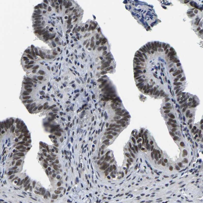 SKAR Antibody - BSA Free Immunohistochemistry: SKAR Antibody - BSA Free [NBP1-92392]