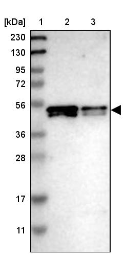 SKAR Antibody - BSA Free Western Blot: SKAR Antibody - BSA Free [NBP1-92392]