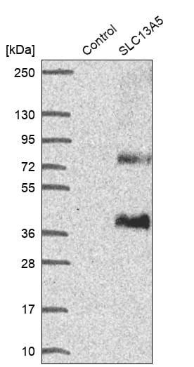 SLC13A5 Antibody - BSA Free Western Blot: SLC13A5 Antibody - BSA Free [NBP1-92394]