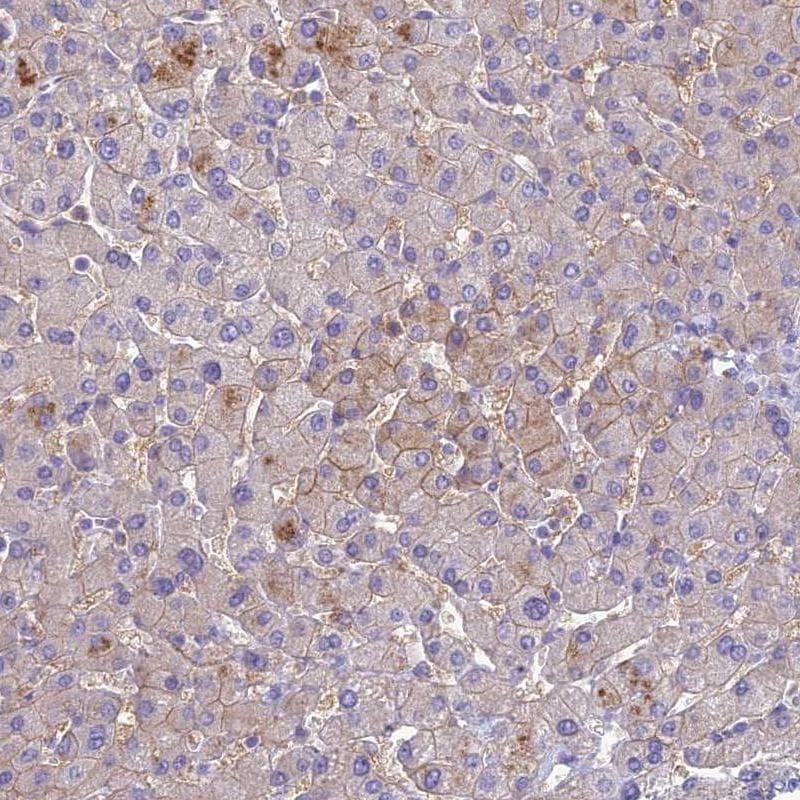 SLC13A5 Antibody - BSA Free Immunohistochemistry: SLC13A5 Antibody - BSA Free [NBP1-92394]