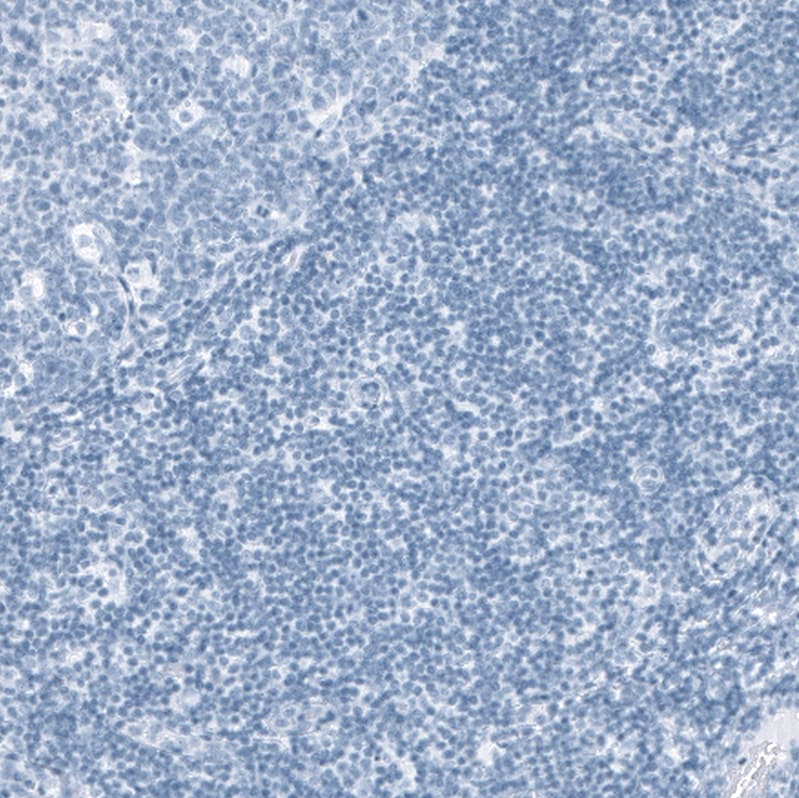 SLC22A8 Antibody - BSA Free Immunohistochemistry: SLC22A8 Antibody - BSA Free [NBP1-92396]