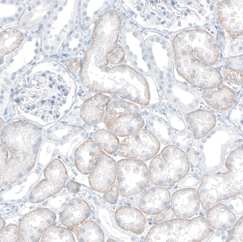 SLC22A8 Antibody - BSA Free Immunohistochemistry: SLC22A8 Antibody - BSA Free [NBP1-92396]